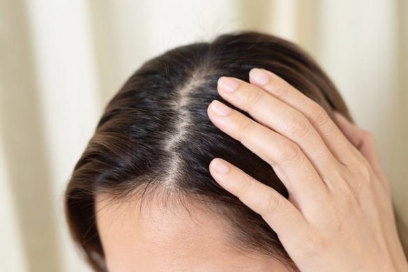 scalp treatment