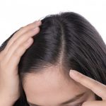 Scalp Care Treatment - Lafz