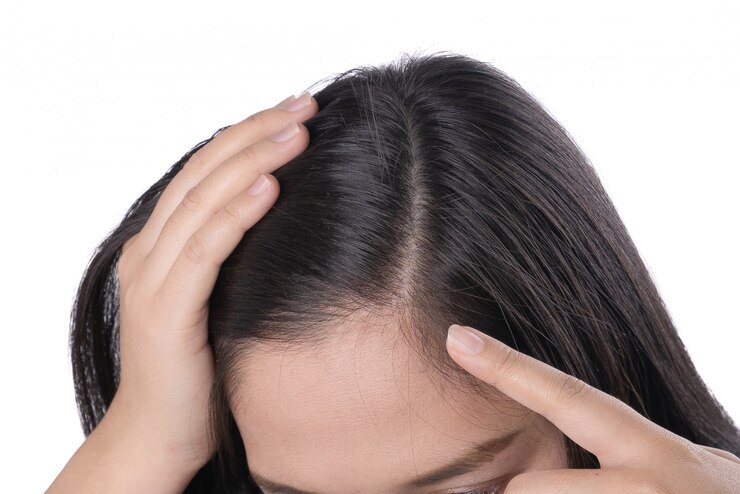 Scalp Care: Expert Tips for Common Scalp Problems | Lafz